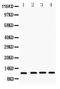 Cystatin-B antibody, PA5-79083, Invitrogen Antibodies, Western Blot image 