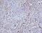DNA Topoisomerase II Alpha antibody, A00953, Boster Biological Technology, Immunohistochemistry frozen image 