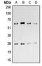 CD69 Molecule antibody, LS-C368584, Lifespan Biosciences, Western Blot image 