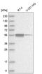 Zinc Finger Protein 114 antibody, HPA025019, Atlas Antibodies, Western Blot image 