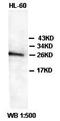 BCL2L2-PABPN1 Readthrough antibody, orb77278, Biorbyt, Western Blot image 