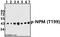 Nucleophosmin 1 antibody, A00450T199, Boster Biological Technology, Western Blot image 