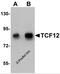 Transcription Factor 12 antibody, 5999, ProSci Inc, Western Blot image 