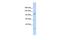 Mtr4 Exosome RNA Helicase antibody, PA5-41280, Invitrogen Antibodies, Western Blot image 