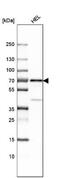 Lymphocyte-specific adapter protein Lnk antibody, NBP1-87867, Novus Biologicals, Western Blot image 