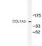 Collagen Type I Alpha 2 Chain antibody, LS-C177036, Lifespan Biosciences, Western Blot image 