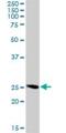 RAB32, Member RAS Oncogene Family antibody, H00010981-D01P, Novus Biologicals, Western Blot image 