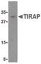 TIR Domain Containing Adaptor Protein antibody, PA5-20027, Invitrogen Antibodies, Western Blot image 