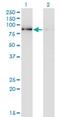 SCY1 Like Pseudokinase 3 antibody, H00057147-M01, Novus Biologicals, Western Blot image 