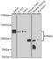 PMS1 Homolog 2, Mismatch Repair System Component antibody, A6947, ABclonal Technology, Western Blot image 