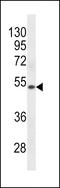 Keratin 72 antibody, LS-C157855, Lifespan Biosciences, Western Blot image 