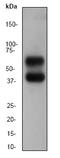 Calcium/Calmodulin Dependent Protein Kinase II Beta antibody, ab52476, Abcam, Western Blot image 