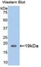 Chloride Intracellular Channel 4 antibody, MBS2001632, MyBioSource, Western Blot image 