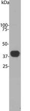 Zebrin II antibody, MBS415126, MyBioSource, Western Blot image 