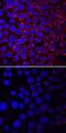 LCK Proto-Oncogene, Src Family Tyrosine Kinase antibody, MAB7369, R&D Systems, Immunocytochemistry image 