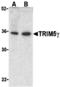 Tripartite motif-containing protein 5 antibody, A01359, Boster Biological Technology, Western Blot image 