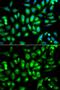 Cholinergic Receptor Muscarinic 2 antibody, GTX53938, GeneTex, Immunofluorescence image 