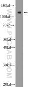 Regulator Of G Protein Signaling Like 1 antibody, 25836-1-AP, Proteintech Group, Western Blot image 