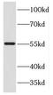 Kinesin Light Chain 3 antibody, FNab04596, FineTest, Western Blot image 