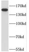 Nephrocystin 4 antibody, FNab05817, FineTest, Western Blot image 