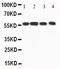 Calcium/Calmodulin Dependent Protein Kinase Kinase 1 antibody, PA5-78908, Invitrogen Antibodies, Western Blot image 