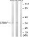 CTD Small Phosphatase 1 antibody, abx014323, Abbexa, Western Blot image 