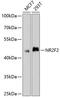 Nuclear Receptor Subfamily 2 Group F Member 2 antibody, GTX66055, GeneTex, Western Blot image 