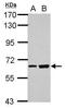 Spermatogenesis Associated 16 antibody, PA5-28978, Invitrogen Antibodies, Western Blot image 