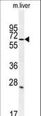 Leucine Rich Repeat And Ig Domain Containing 1 antibody, LS-C165787, Lifespan Biosciences, Western Blot image 