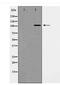 EPH Receptor A1 antibody, TA347943, Origene, Western Blot image 