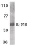 Interleukin 21 Receptor antibody, PA5-19983, Invitrogen Antibodies, Western Blot image 