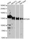 Integrin Subunit Alpha 5 antibody, A6209, ABclonal Technology, Western Blot image 