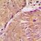 Stathmin 1 antibody, orb339192, Biorbyt, Immunohistochemistry paraffin image 