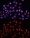 Regulator Of Chromosome Condensation 1 antibody, GTX64560, GeneTex, Immunofluorescence image 
