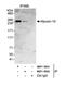 Myosin Heavy Chain 10 antibody, NBP1-18931, Novus Biologicals, Western Blot image 