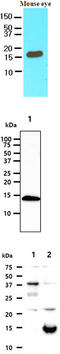 Cellular Retinoic Acid Binding Protein 2 antibody, MBS200133, MyBioSource, Western Blot image 