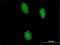 Ubiquitin Like With PHD And Ring Finger Domains 2 antibody, H00115426-M01, Novus Biologicals, Immunocytochemistry image 