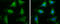 Acyl-CoA Dehydrogenase Medium Chain antibody, GTX100487, GeneTex, Immunocytochemistry image 