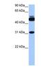 Cylicin 2 antibody, NBP1-54921, Novus Biologicals, Western Blot image 