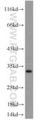 Tetraspanin 2 antibody, 20463-1-AP, Proteintech Group, Western Blot image 