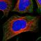 Coiled-Coil Domain Containing 167 antibody, NBP1-94107, Novus Biologicals, Immunocytochemistry image 