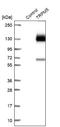 Transient Receptor Potential Cation Channel Subfamily M Member 5 antibody, NBP2-48760, Novus Biologicals, Western Blot image 