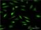 Zinc Finger Protein 274 antibody, H00010782-M02, Novus Biologicals, Immunocytochemistry image 