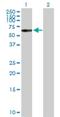 Catenin Alpha 3 antibody, H00029119-D01P, Novus Biologicals, Western Blot image 