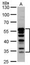 Transcription Factor 7 antibody, PA5-78191, Invitrogen Antibodies, Western Blot image 