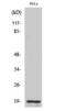 Thyroid Hormone Receptor Beta antibody, GTX86914, GeneTex, Western Blot image 