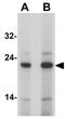 Anterior Gradient 2, Protein Disulphide Isomerase Family Member antibody, GTX31873, GeneTex, Western Blot image 