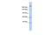 Kinesin Family Member 13B antibody, PA5-40807, Invitrogen Antibodies, Western Blot image 