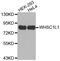 Histone-lysine N-methyltransferase NSD3 antibody, MBS126577, MyBioSource, Western Blot image 