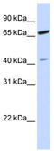 Zinc Finger Protein 334 antibody, TA344476, Origene, Western Blot image 